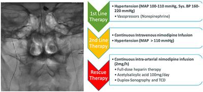 Adverse Events and Complications in Continuous Intra-arterial Nimodipine Infusion Therapy After Aneurysmal Subarachnoid Hemorrhage